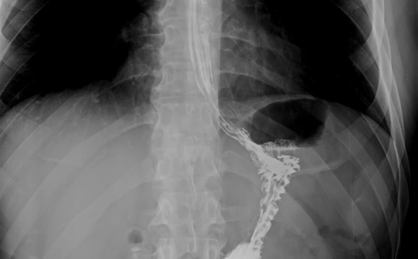 Abdominal X-ray interpretation
